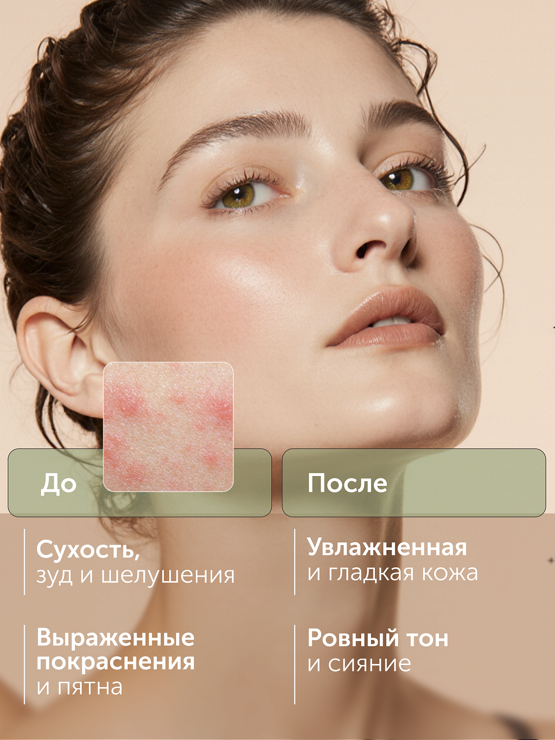 Успокаивающая сыворотка CALM EXPERT против сухости и покраснений